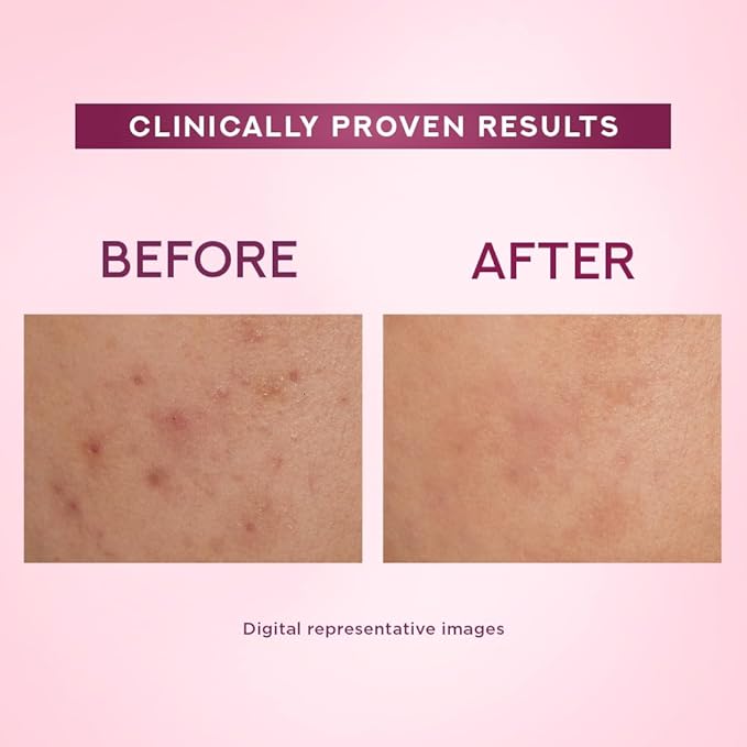 Pond's Bright Beauty Light Cream with UV Filter & Niacinamide 35g | Brightening Face Cream - Image 2